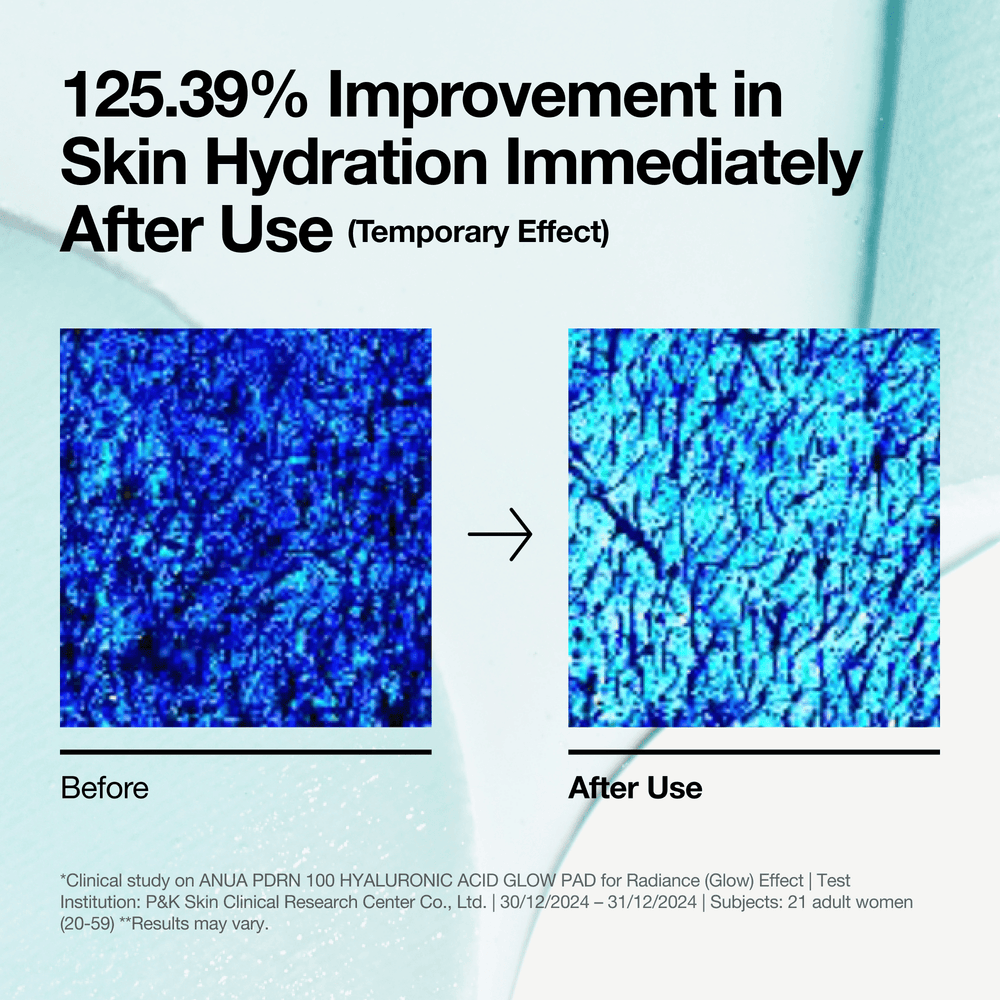 [anua] PDRN 100 Hyaluronic Acid Glow Pad 180ml 60ea - KuteSkin