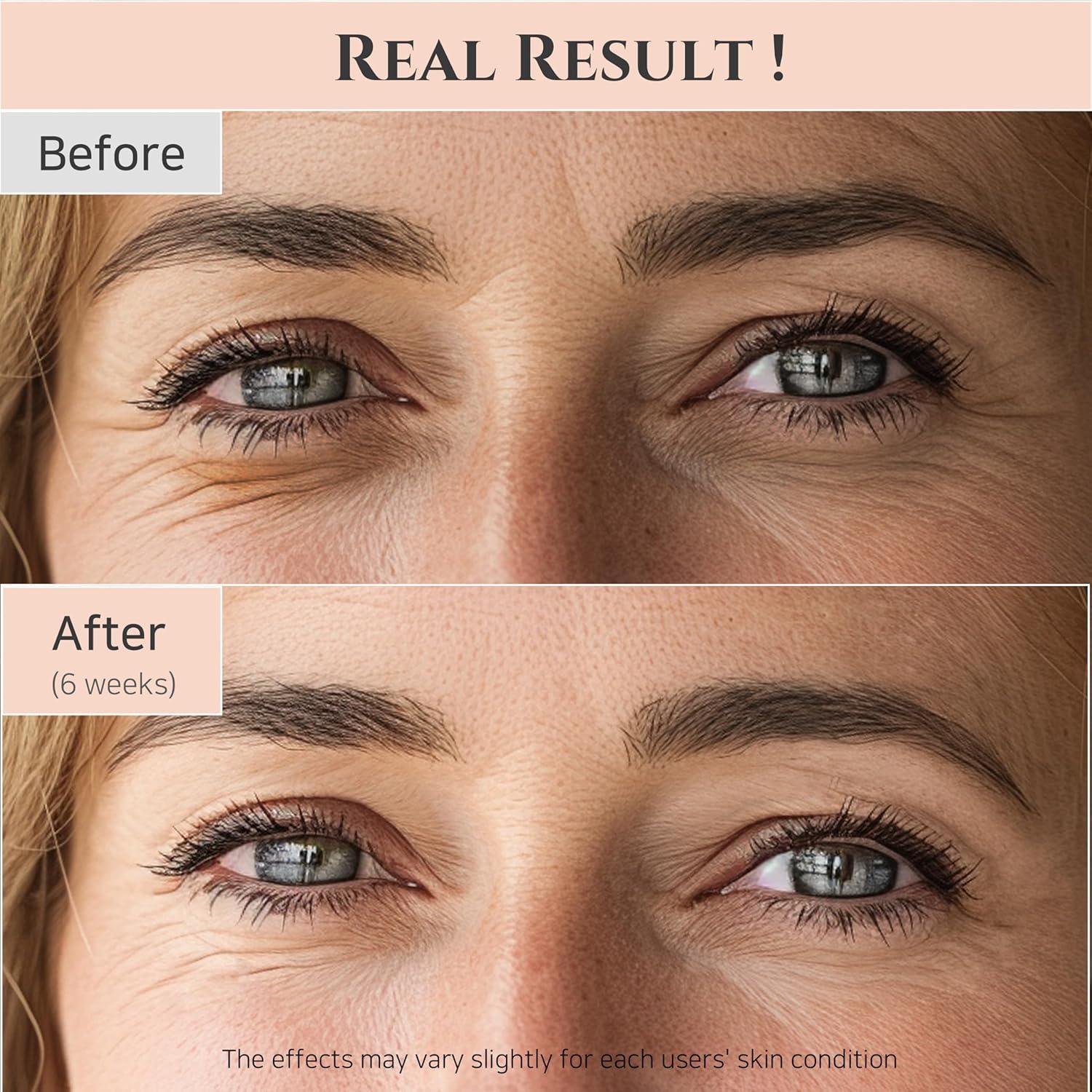 [BeautyOfJoseon] Revive Eye Serum : Ginseng + Retinal 30ml - KuteSkin