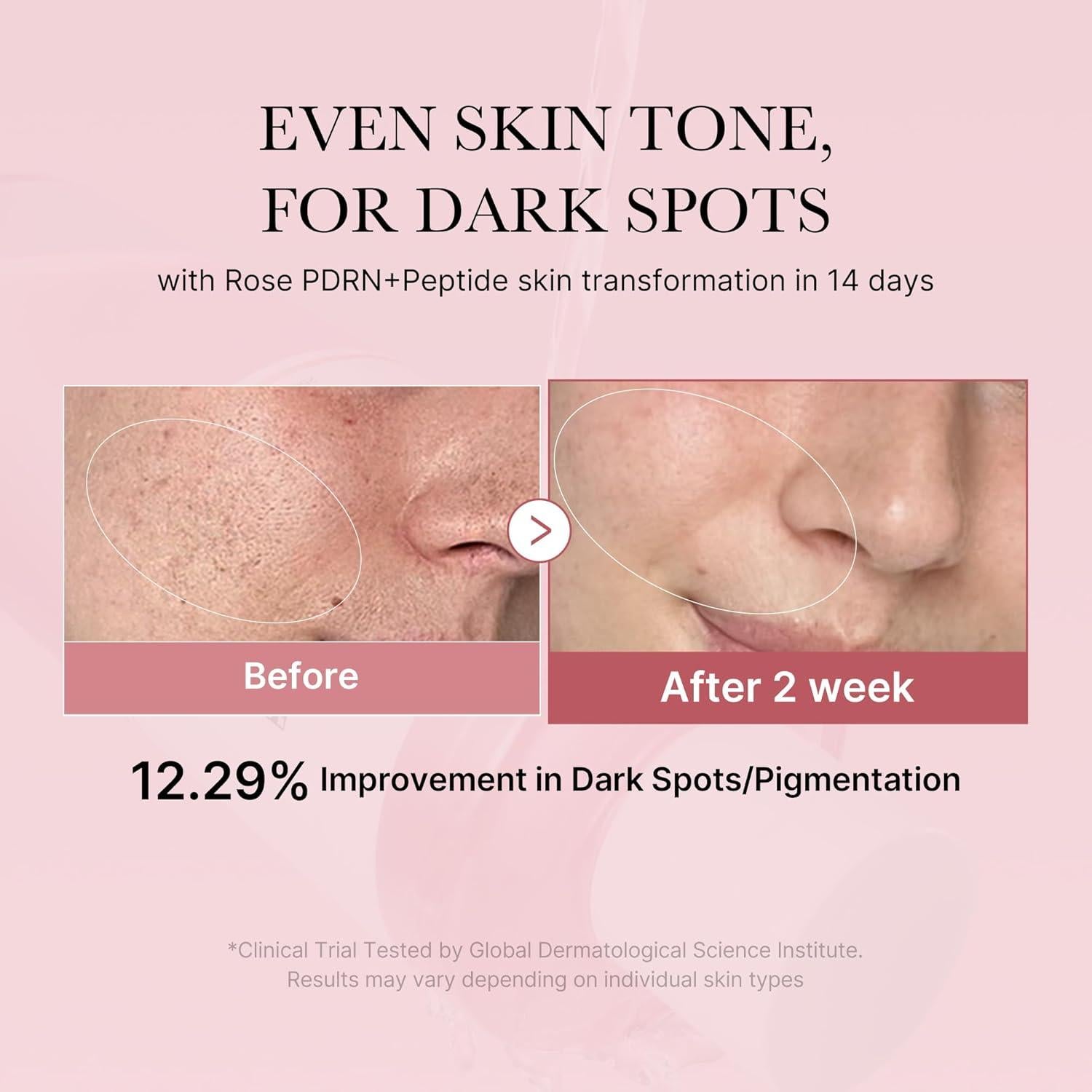 [Medicube] PDRN Pink Cica Soothing Toner 250ml - KuteSkin